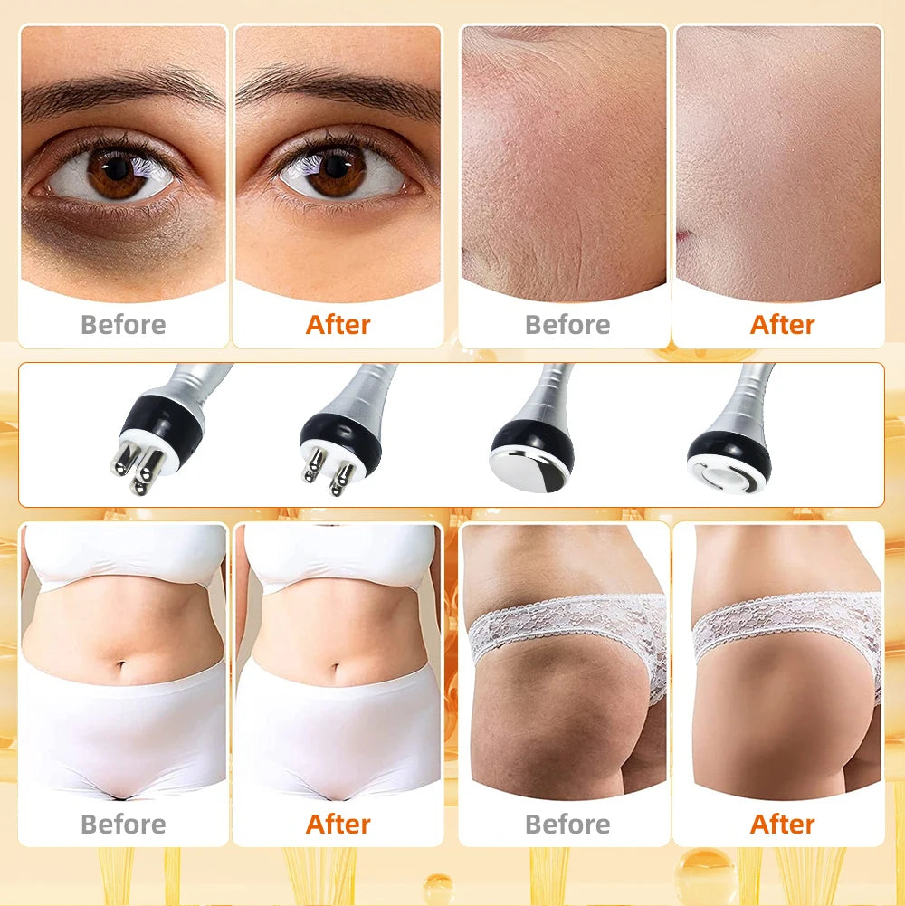 SlimSculpt Pro